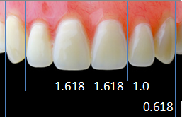 歯の黄金比の写真
