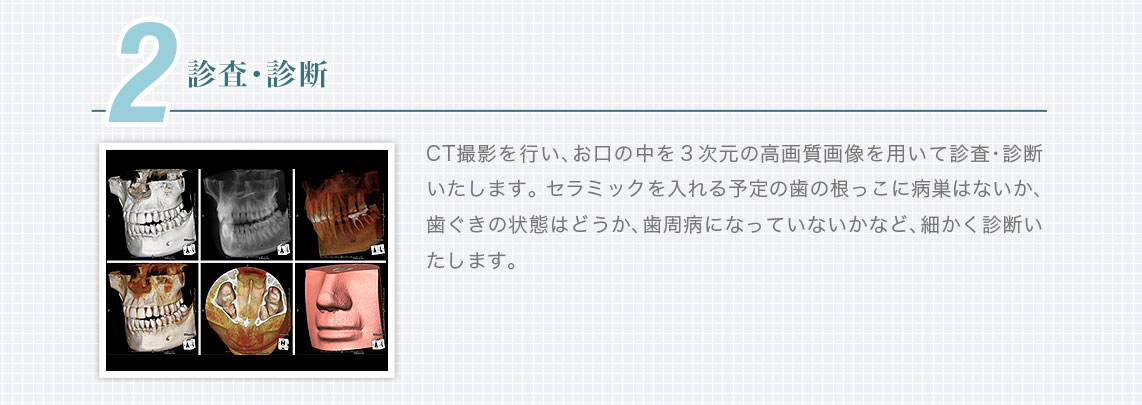 2.徹底した診査・診断