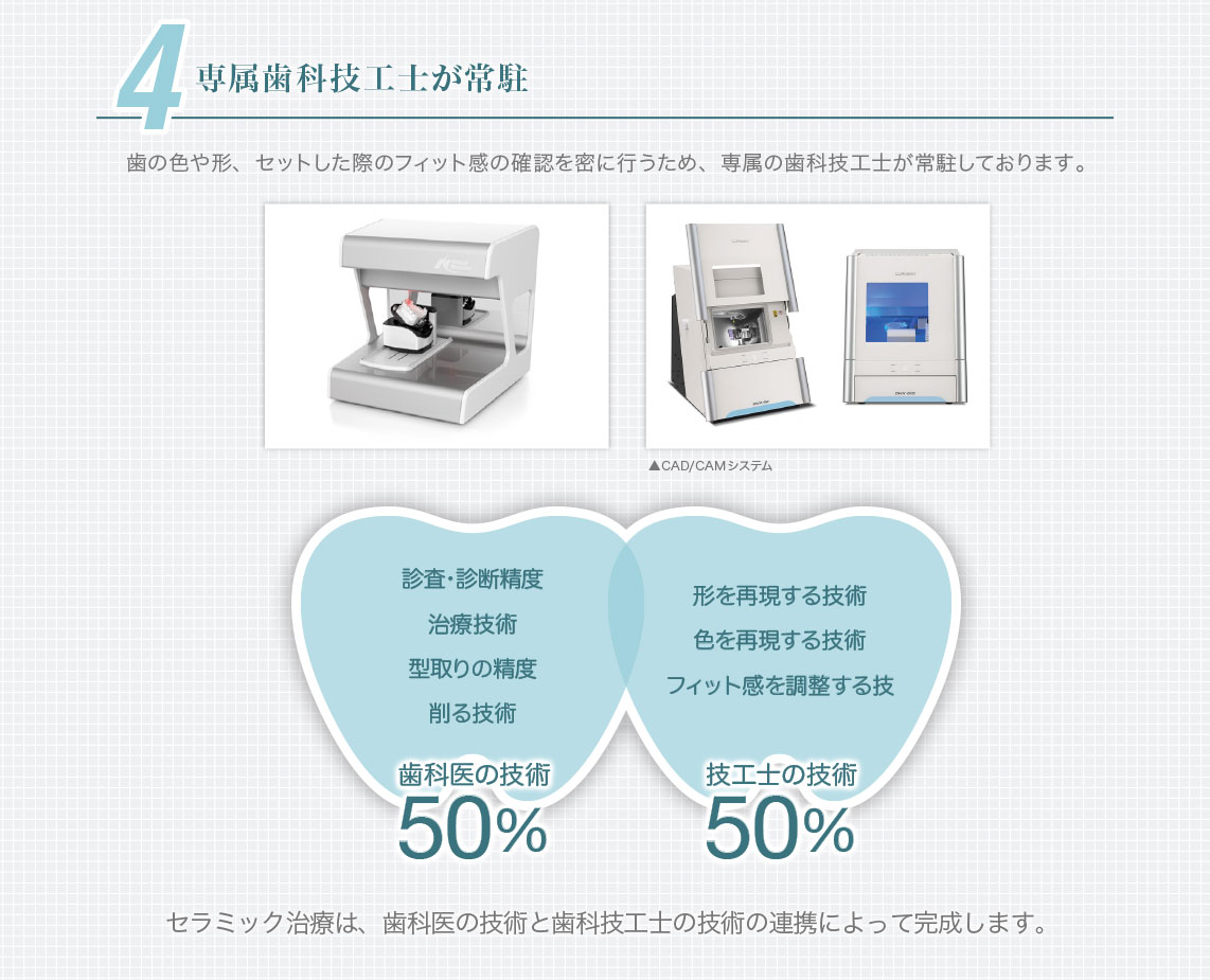 4.専属歯科技工士が常駐