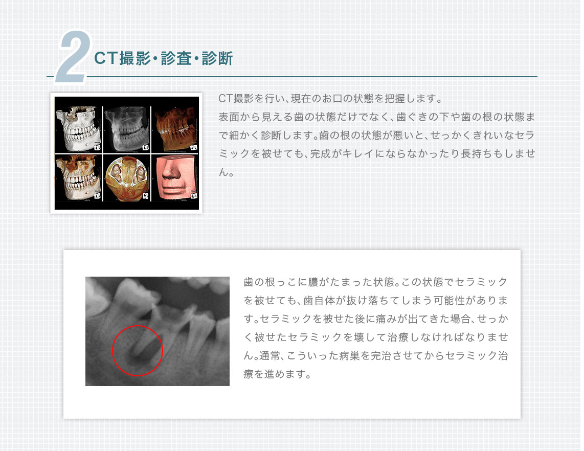2.CT撮影・診査・診断