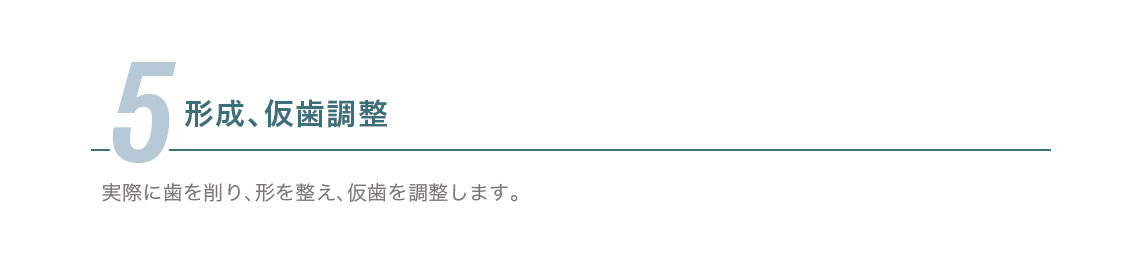 5.形成、仮歯調整