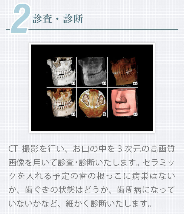 2.徹底した診査・診断