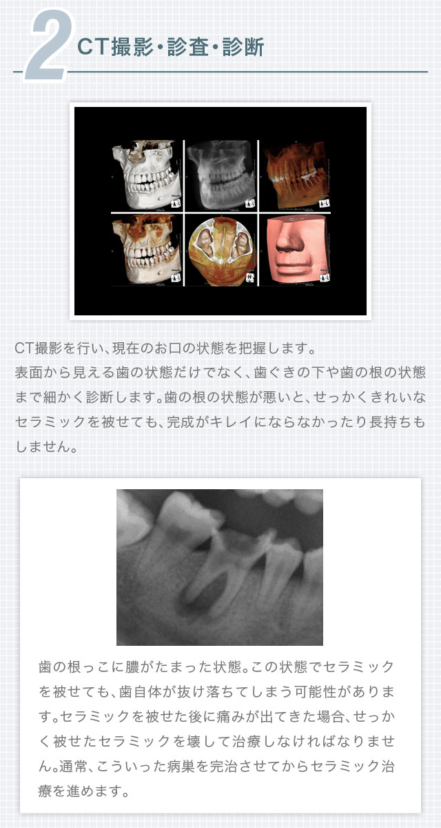 2.CT撮影・診査・診断