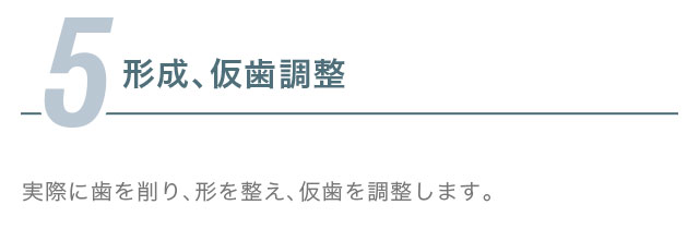 5.形成、仮歯調整
