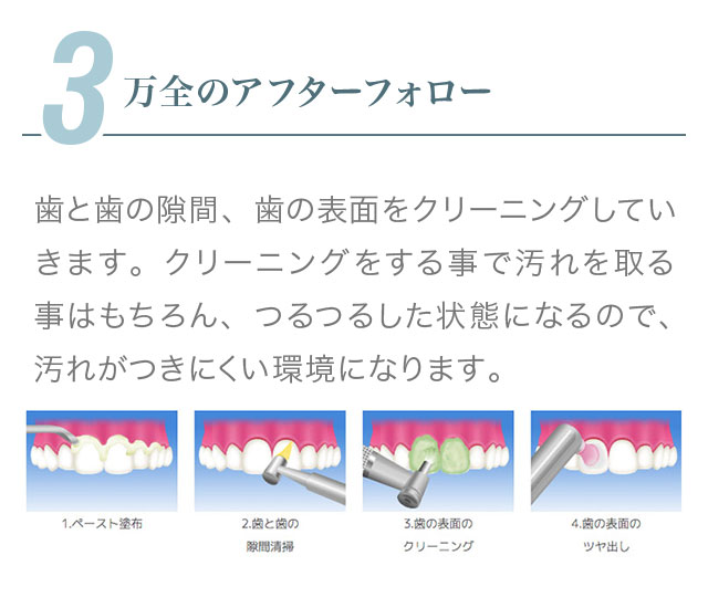 3.歯のクリーニング