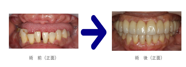 正面の前後の写真
