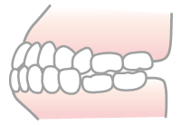 上下顎前突のイラスト