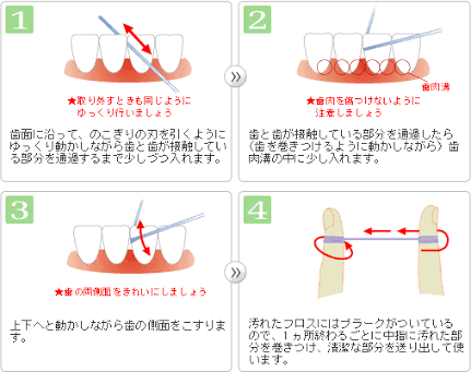 デンタルフロス