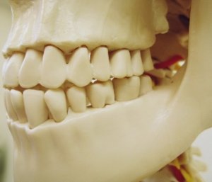 顎骨模型の写真