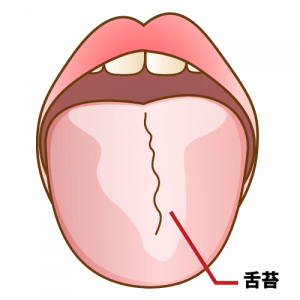 舌苔のイラスト