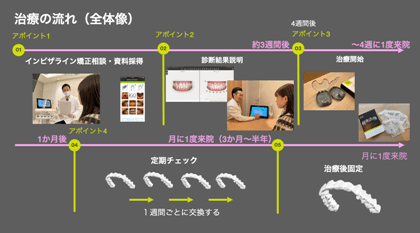 インビザラインの流れ