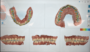 模型診断画像の写真