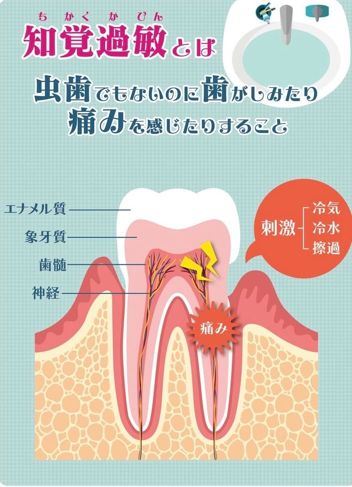 知覚過敏とは