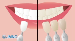 ホワイトニングのイラスト