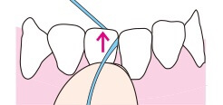 デンタルフロスの取り出し方イラスト
