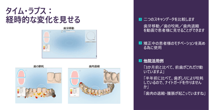 画像3.タイム・ラプス