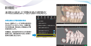 画像7.CBCTとiTERO