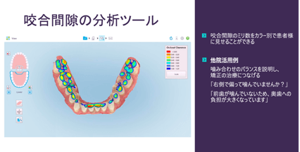 画像６.咬合間隙の分析ツール