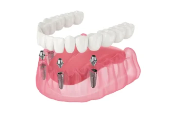 オールオン4のイメージ画像