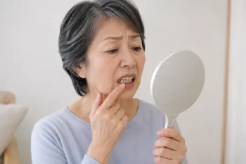 歯石を放置してしまい歯周病に繋がってしまった女性